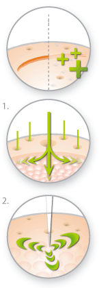 dermastamp_table