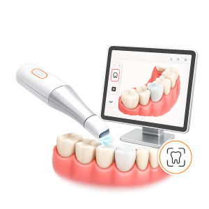 A digital scan of your tooth,
no messy impression material.